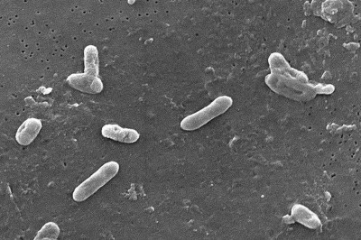 Bordetella bronchiseptica coccobacilli Bacteria