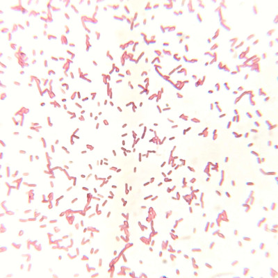 Aeromonas veronii biovar sobria Gram Stain on Microscope Slide