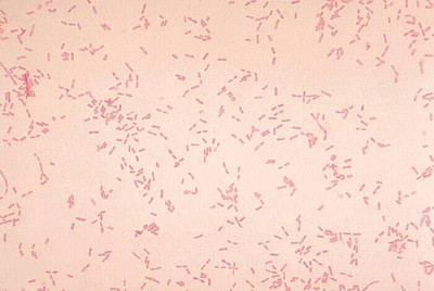 Alcaligenes faecalis Bacteria