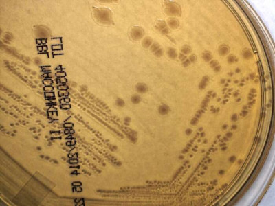 Yersinia pseudotuberculosis Colonies