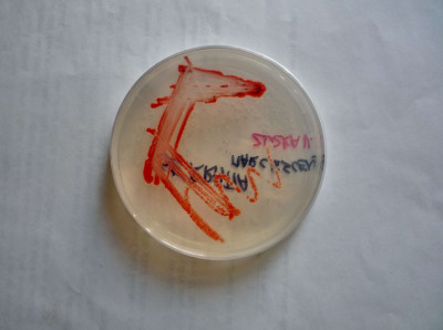 Serratia marcescens on Agar Plate