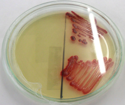 Serratia marcescen