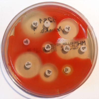 Serratia marcescens - Antibiogram