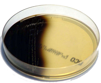 Enterococcus faecalis