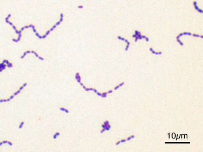 Streptococcus mutans Gram Staining