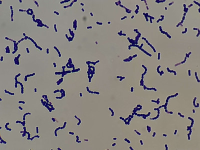 Viridans strptococci in Gram Stain