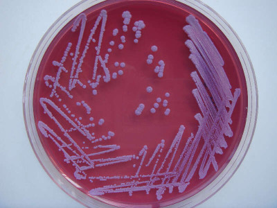 Colonies of Burkholderia pseudomallei on Ashdown Agar