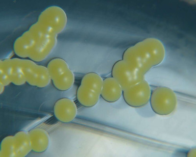 Micrococcus luteus Colonies on Tryptic Soy Agar