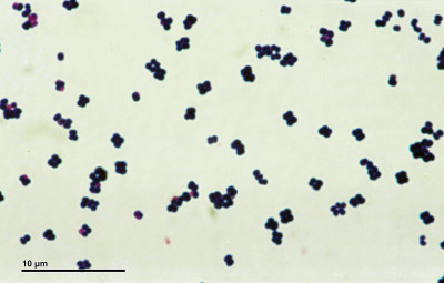 Eubacteria Micrococcus luteus Bacteria