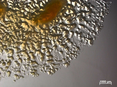 Myxococcus xanthus