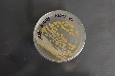 Kitasatospora setae NRRL B-16185 (Type Strain)