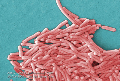 Legionella pneumophila Scanning Electron Micrograph