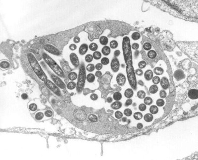 Legionella Pneumophila inside a Cultured Human Lung Fibroblast