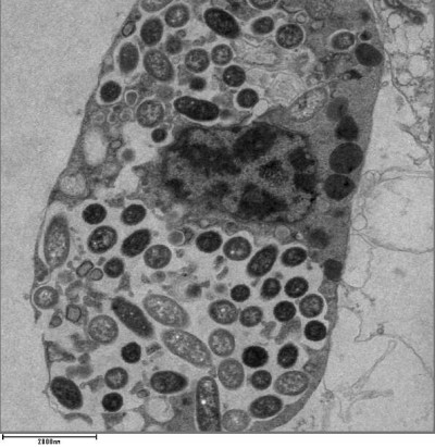 TEM Image of Legionella pneumophila