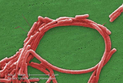 Scanning Electron Microscopic Image of Legionella pneumophila Bacteria Morphology