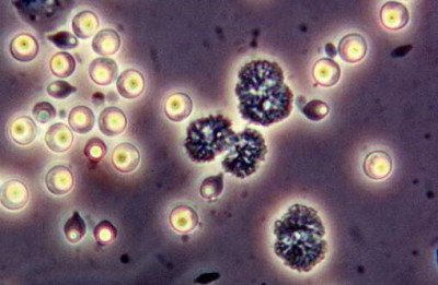 Spores of Pasteuria ramosa