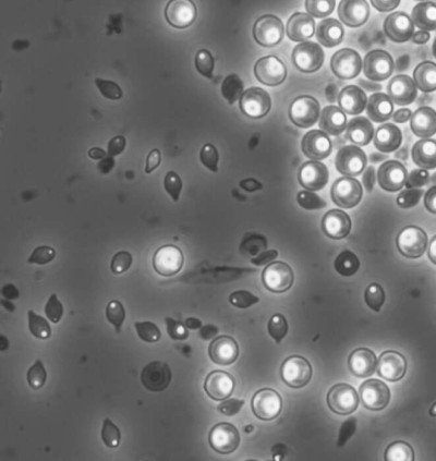 Pasteuria ramosa Spores