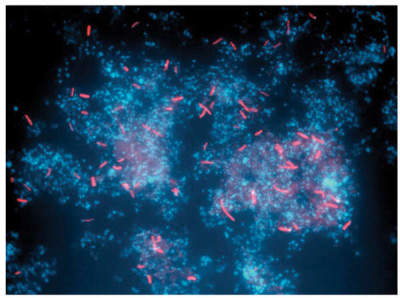 FISH Analyses of Sulfobacillus Rods