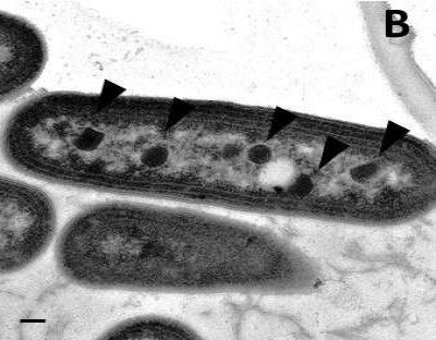 Electron Micrograph of Beta-Carboxysomes