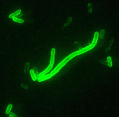 Fluorescent Yersinia pestis