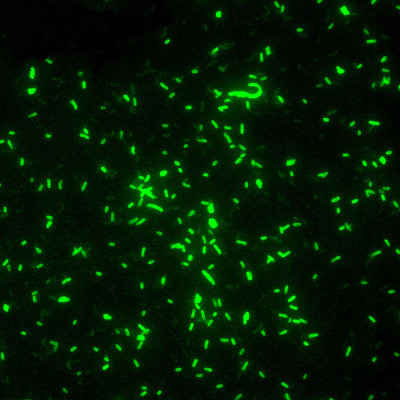 Fluorescent Yersinia pestis