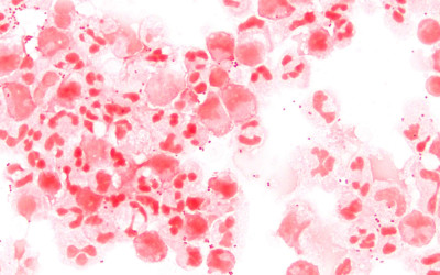 Photomicrograph of Neisseria meningitidis