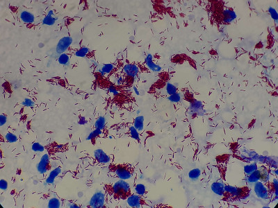 Mycobacterium leprae in Magnification of 2000X