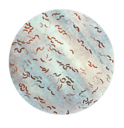 Vibrio cholerae Gram Stain