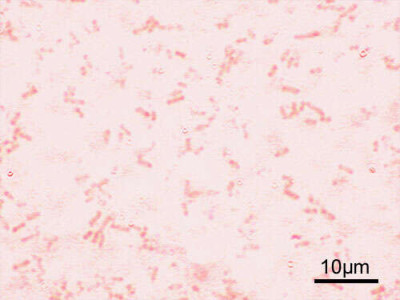 Microscopic Image of Shigella flexneri