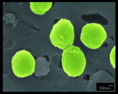 Prochlorococcus MIT9215