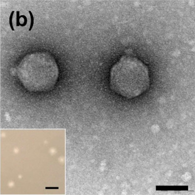 Phages of Ochrobactrum sp. POC9