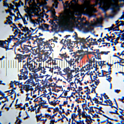 Exploring Bacterial Cultures from Urine