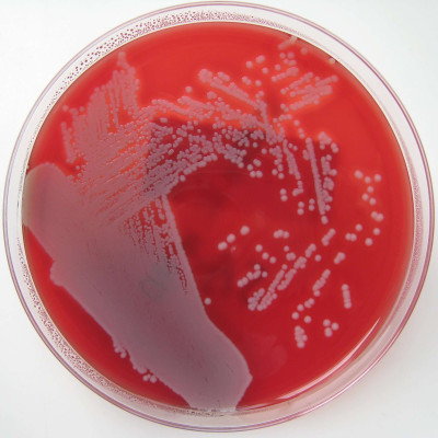 Staphylococcus aureus Growing on Blood Agar