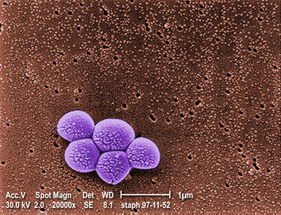 Methicillin Resistant Staphylococcus aureus Bacteria