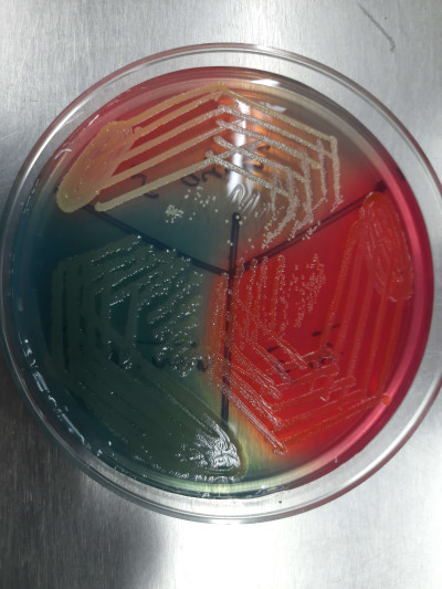 CLED Agar