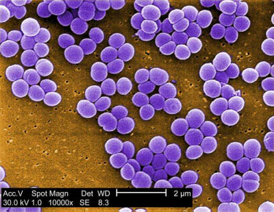 Strain of Staphylococcus aureus Bacteria