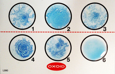 Latex Slide Agglutination Test