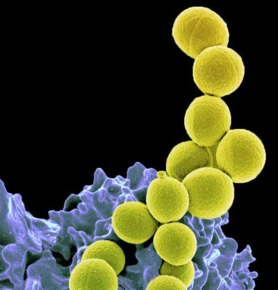 Methicillin-Resistant Staphylococcus aureus Bacteria