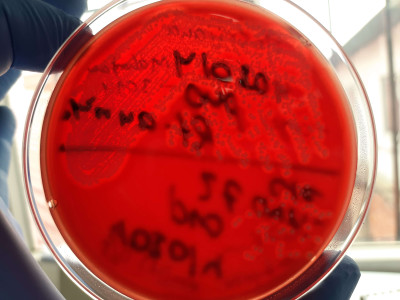 Beta-Hemolytic Staphylococcus aureus Strains on Blood Agar