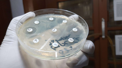 Antibiogram of Staphylococcus aureus on Mueller-Hinton Agar