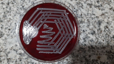 Staphylococcus aureus Growth after a Day of Incubation