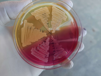 MSA Having Growth of Staphylococcus aureus and CoNS