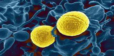 Staphylococcus aureus Bacteria