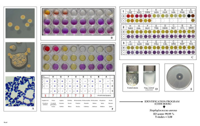 Staphylococcus aureus Biochemical Tests for Identification