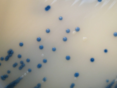 MRSA on Brilliance MRSA Chromogenic Agar