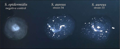 Coagulase Test in S. aureus and S. epidermidis