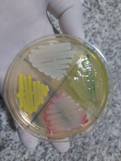 Staphylococcus, Pseudomonas, Micrococcus and Serratia Growth on MHA