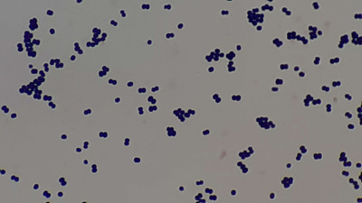 Micrococcus in Gram Stain