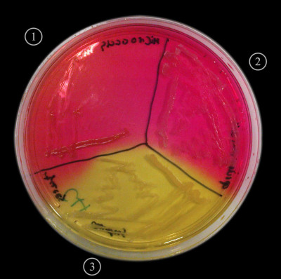 Micrococcus species, Staphylococcus epidermidis and Staphylococcus aureus