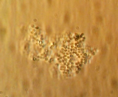 Micrococcus luteus